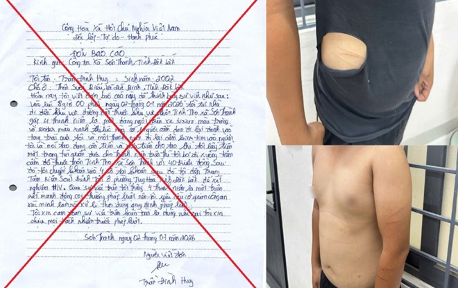 Thanh niên tự gây thương tích, xé áo rồi dựng chuyện bị cướp 40 triệu đồng